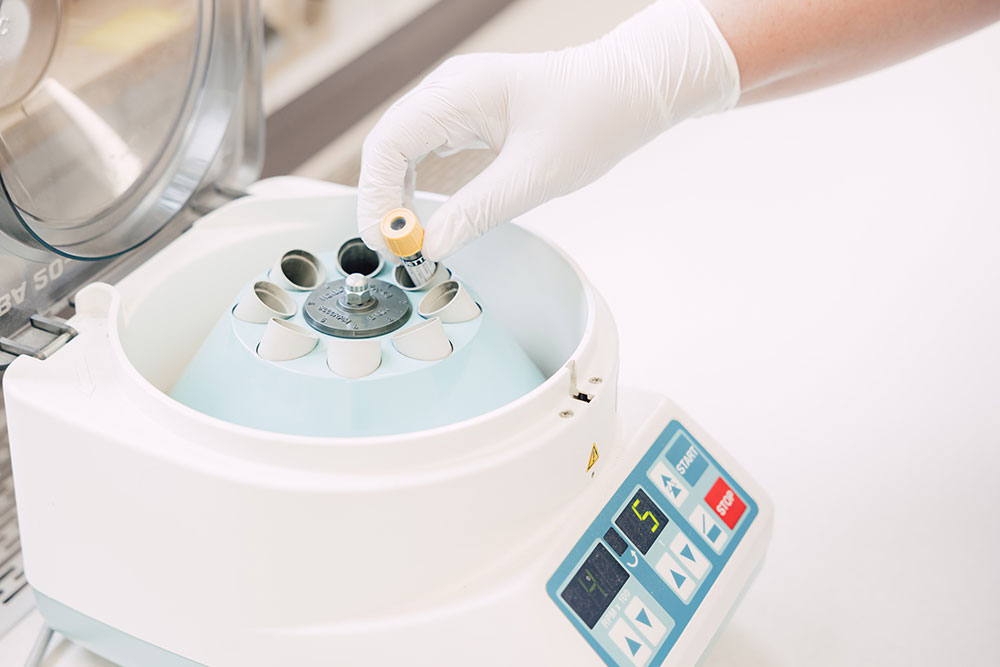 hausarzt-sachsenheim-muendler-urin hausarzt-sachsenheim-muendler- urin